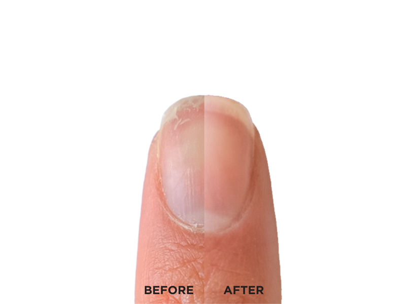 Nail Strengthener RXx