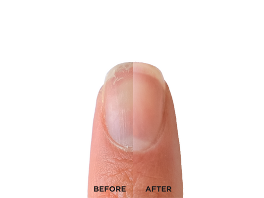 Nail Strengthener RXx