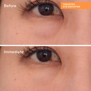 Targeted Eye Depuffer