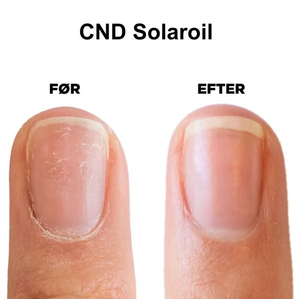 Duo Kit, CND RescueRXx & CND SolarOil