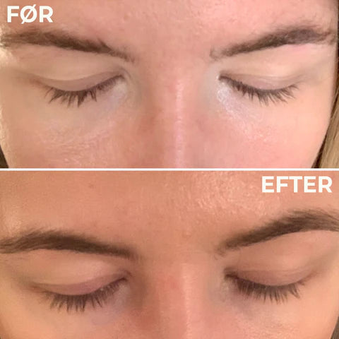 Eyelash Growth Serum