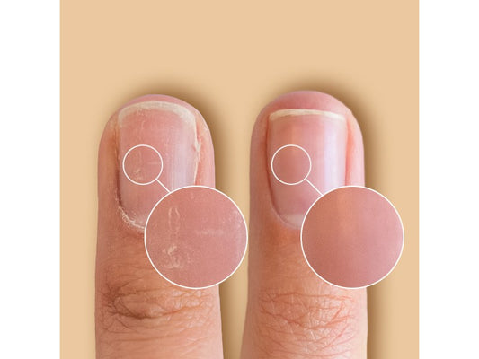 SolarOil Nail & Cuticle Treatment