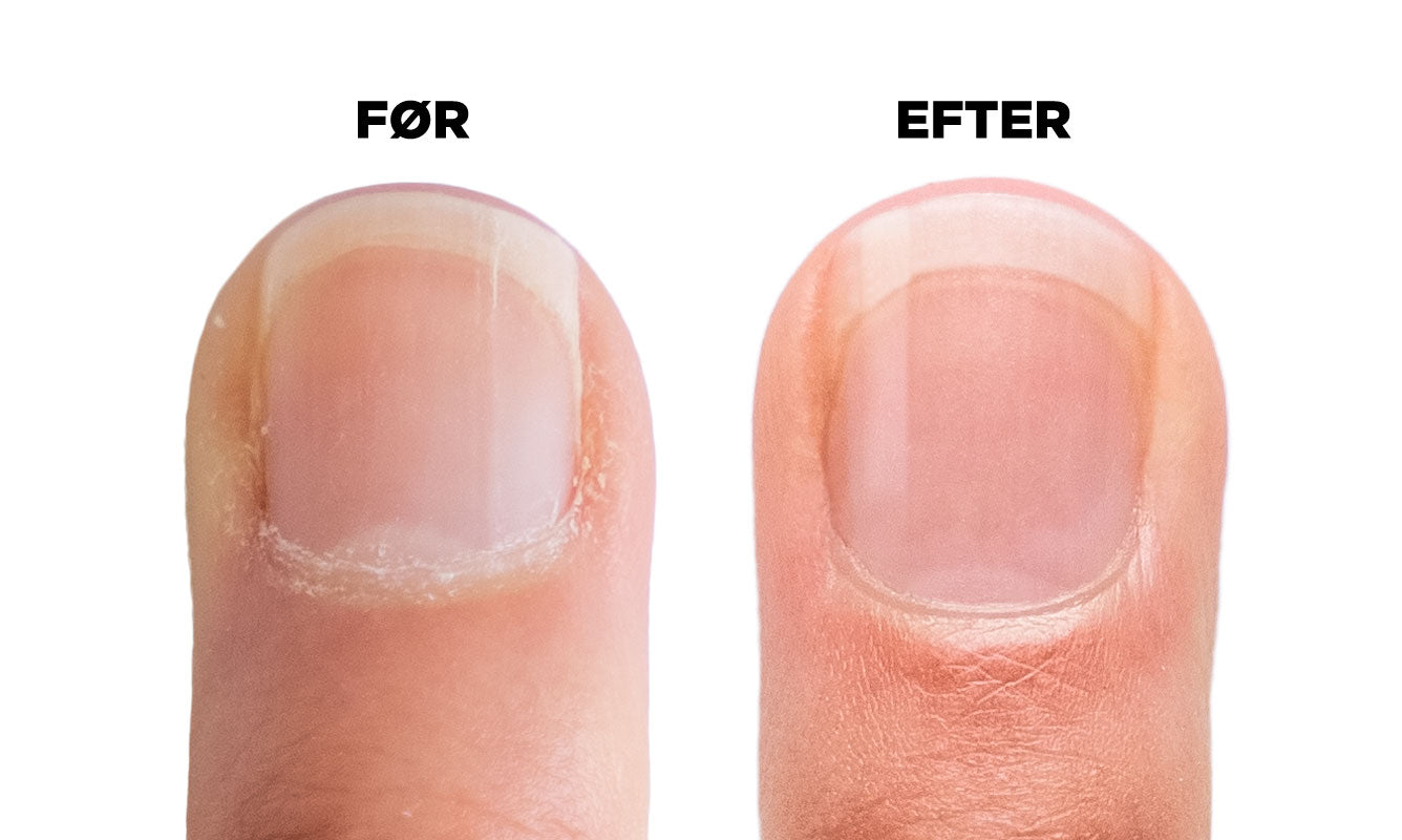 Cuticle Eraser