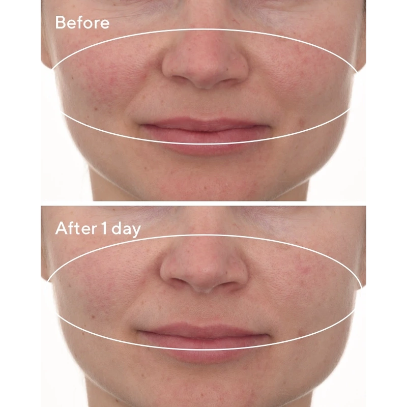 Hydration Cellular Hydration Repair Mask