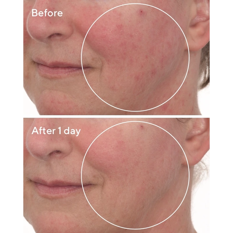 Hydration Cellular Hydration Repair Mask