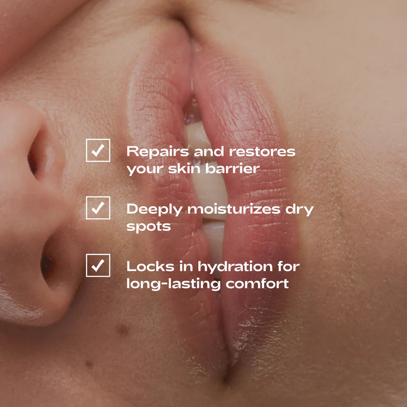 Beyond Balm - Intense Repairing Lip & Skin Balm