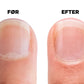 Cuticle Eraser