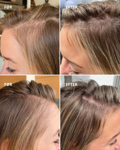 Hair Growth & Enchancing Serum + Micro Needle Roller