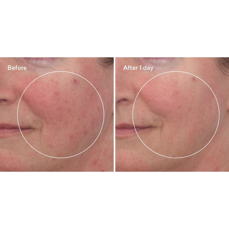 Hydration Cellular Hydration Repair Mask