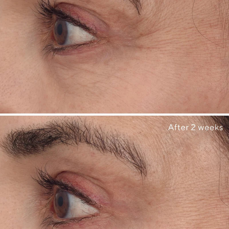 Resurgence Retinal Rescuplt Eye Lift Treatment