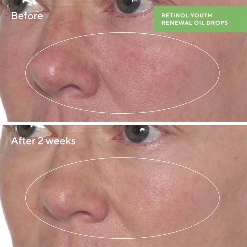 Retinol Youth Renewal Oil Drops 30 ml